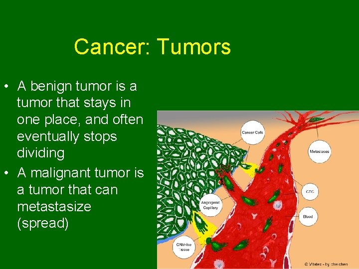 Cancer: Tumors • A benign tumor is a tumor that stays in one place,