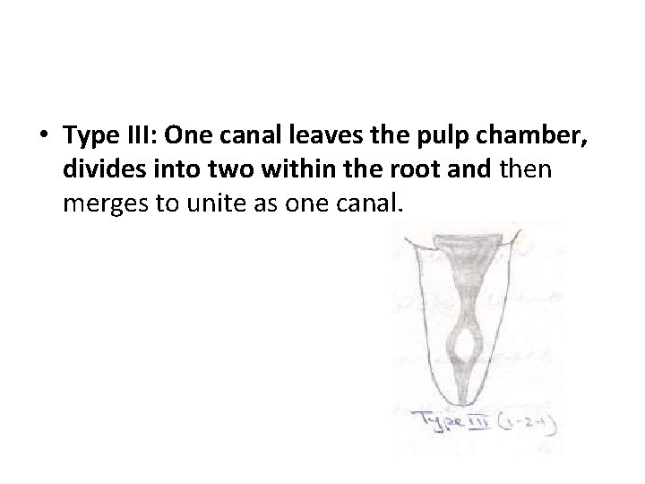  • Type III: One canal leaves the pulp chamber, divides into two within