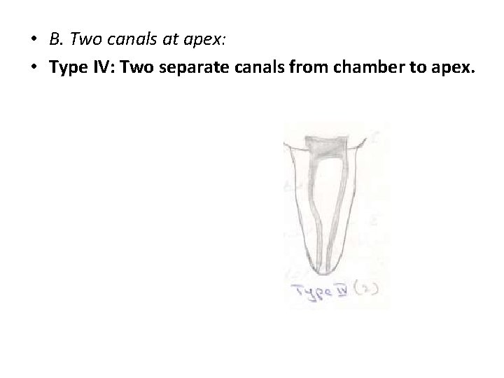  • B. Two canals at apex: • Type IV: Two separate canals from