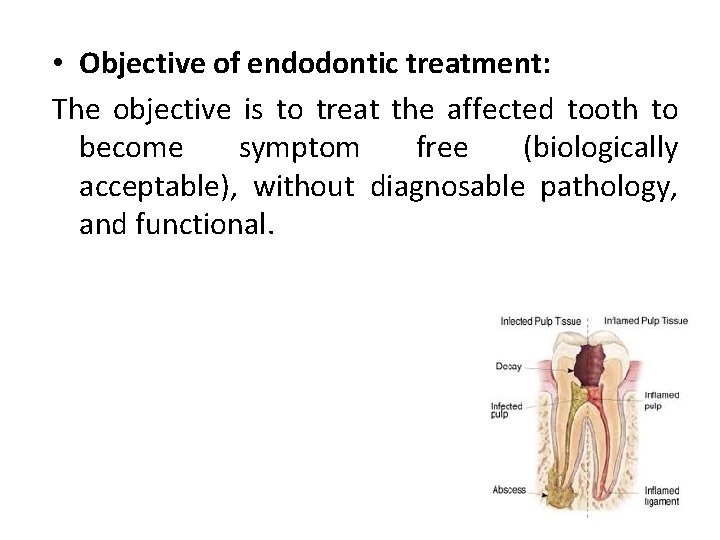  • Objective of endodontic treatment: The objective is to treat the affected tooth