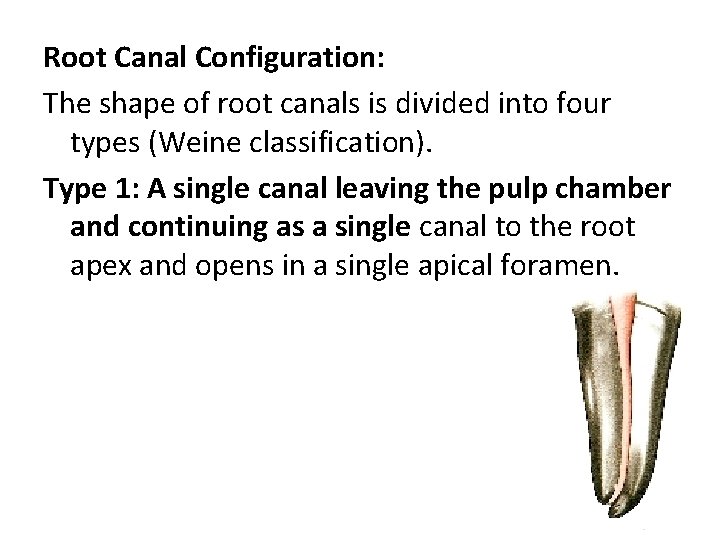 Root Canal Configuration: The shape of root canals is divided into four types (Weine