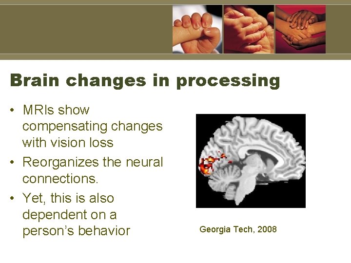 Brain changes in processing • MRIs show compensating changes with vision loss • Reorganizes