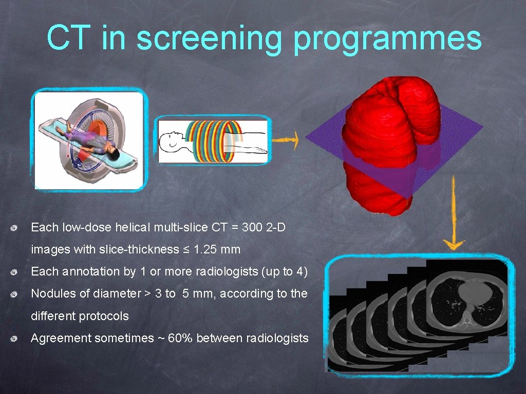 CT in screening programmes Each low-dose helical multi-slice CT = 300 2 -D images