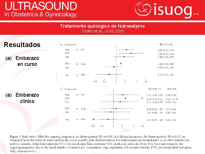 Tratamiento quirúrgico de hidrosalpinx Tsiami et al. , UOG 2016 Resultados (a) Embarazo en