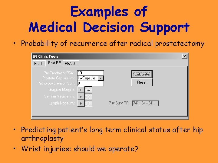 Examples of Medical Decision Support • Probability of recurrence after radical prostatectomy • Predicting