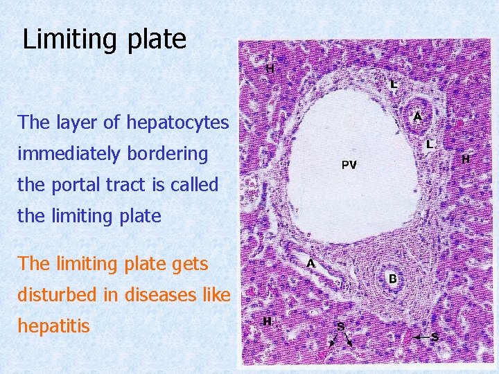 Limiting plate The layer of hepatocytes immediately bordering the portal tract is called the Limiting plate The layer of hepatocytes immediately bordering the portal tract is called the
