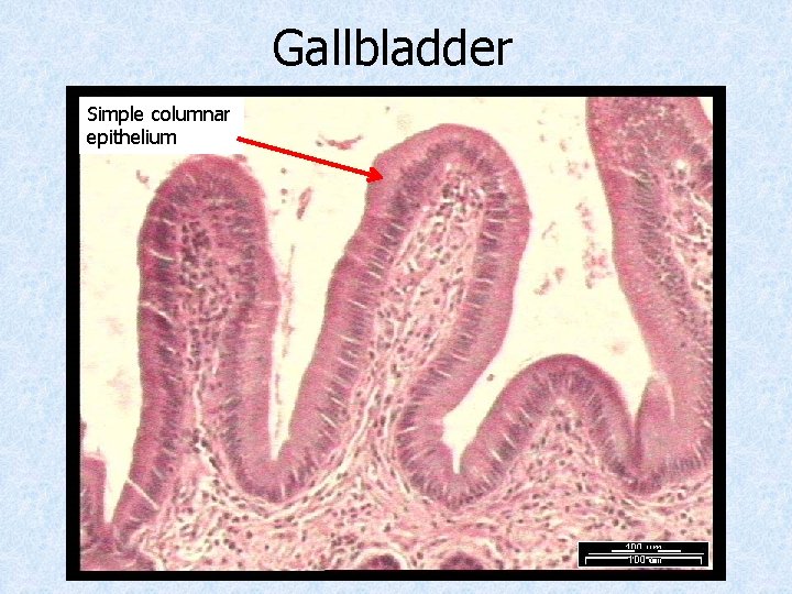 Gallbladder Simple columnar epithelium 