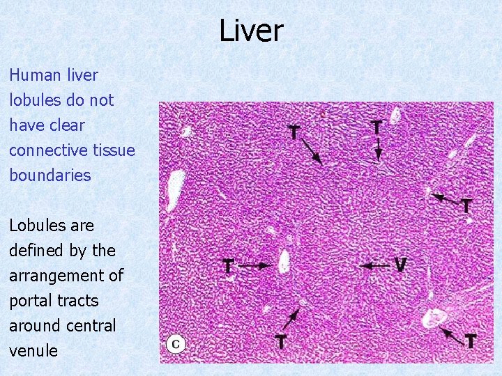 Liver Human liver lobules do not have clear connective tissue boundaries Lobules are defined