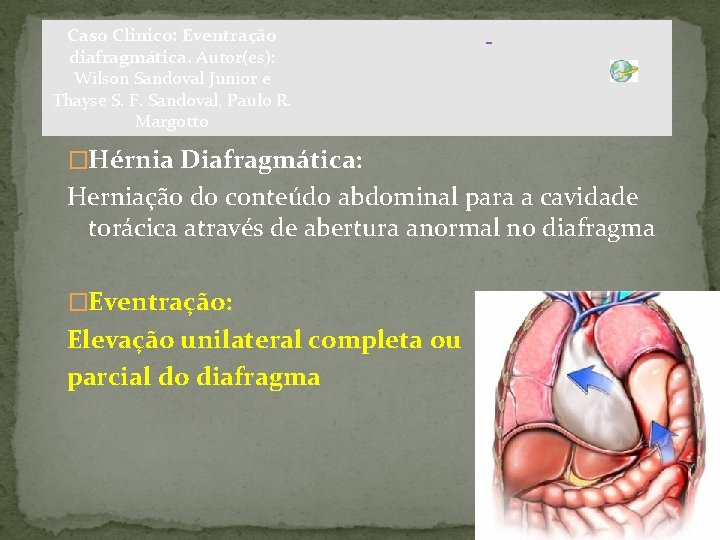 Caso Clinico: Eventração diafragmática. Autor(es): Wilson Sandoval Junior e Thayse S. F. Sandoval, Paulo