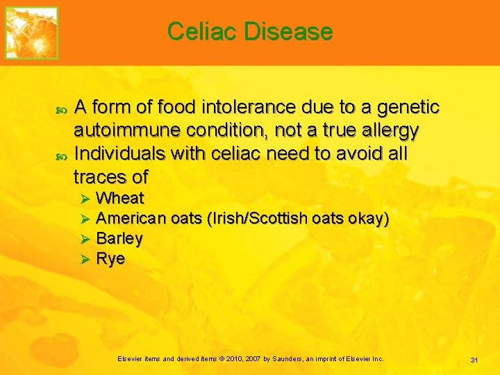Celiac Disease A form of food intolerance due to a genetic autoimmune condition, not