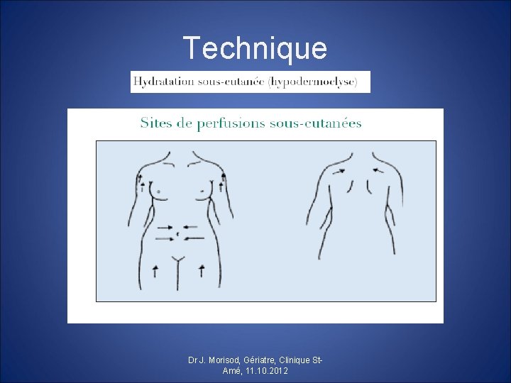 Technique Dr J. Morisod, Gériatre, Clinique St. Amé, 11. 10. 2012 