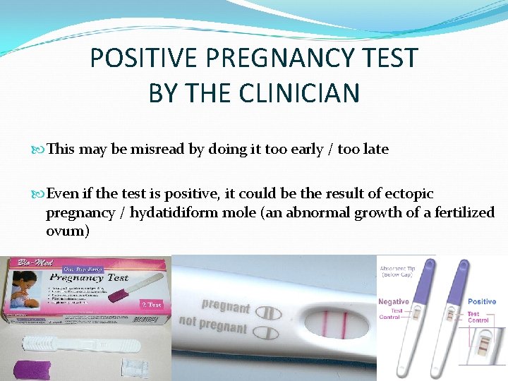 POSITIVE PREGNANCY TEST BY THE CLINICIAN This may be misread by doing it too