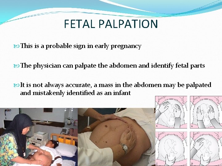 FETAL PALPATION This is a probable sign in early pregnancy The physician can palpate