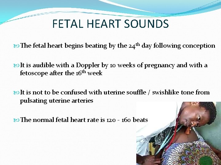 FETAL HEART SOUNDS The fetal heart begins beating by the 24 th day following