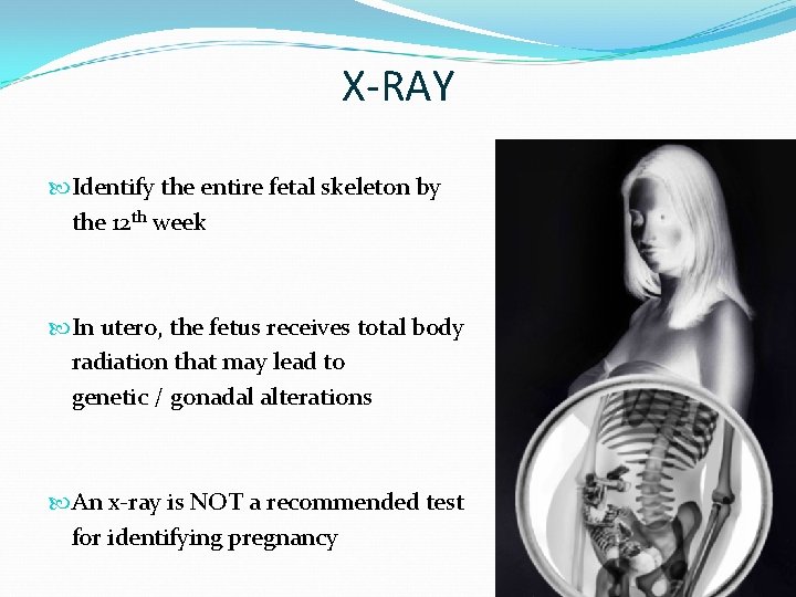 X-RAY Identify the entire fetal skeleton by the 12 th week In utero, the