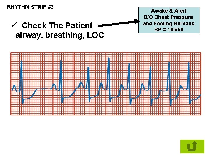 RHYTHM STRIP #2 ü Check The Patient airway, breathing, LOC Awake & Alert C/O