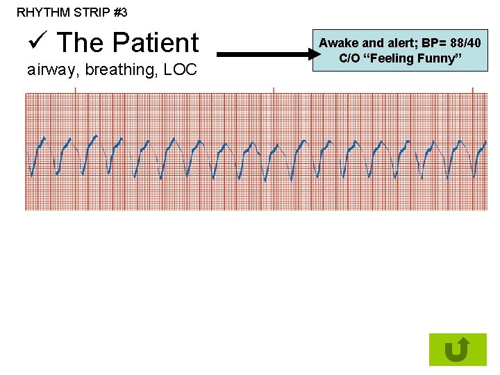 RHYTHM STRIP #3 ü The Patient airway, breathing, LOC Awake and alert; BP= 88/40