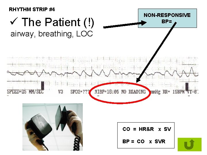 RHYTHM STRIP #4 ü The Patient (!) NON-RESPONSIVE BP= airway, breathing, LOC CO =