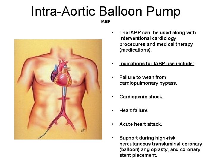 Intra-Aortic Balloon Pump IABP • The IABP can be used along with interventional cardiology