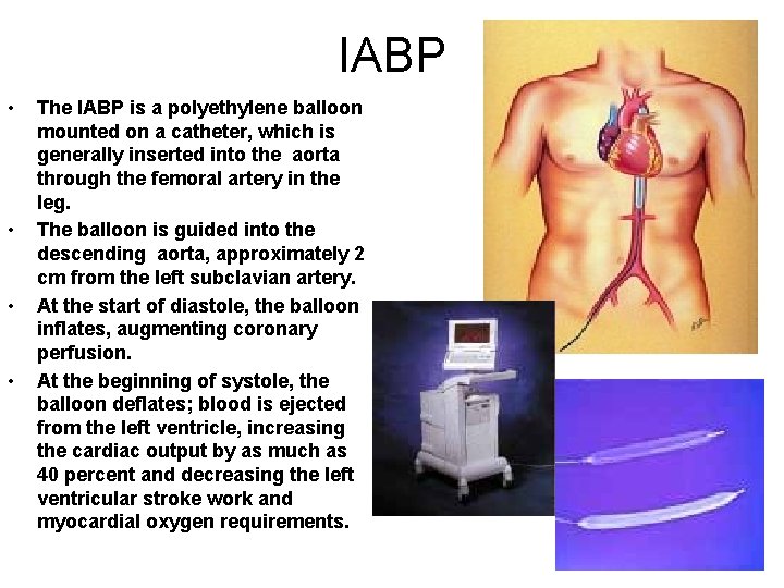 IABP • • The IABP is a polyethylene balloon mounted on a catheter, which