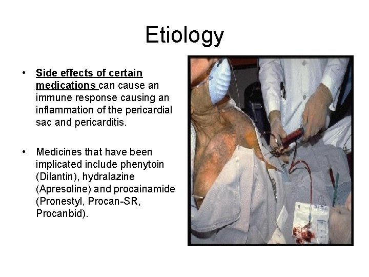 Etiology • Side effects of certain medications can cause an immune response causing an