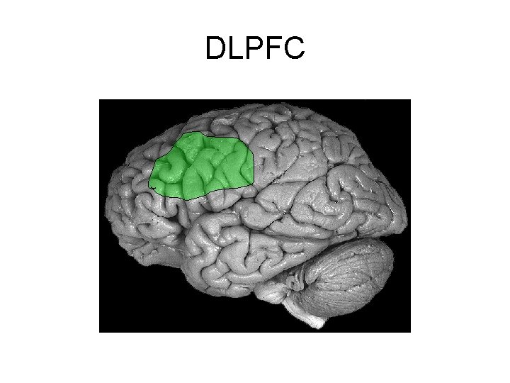 DLPFC 