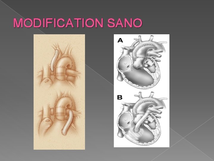 MODIFICATION SANO 