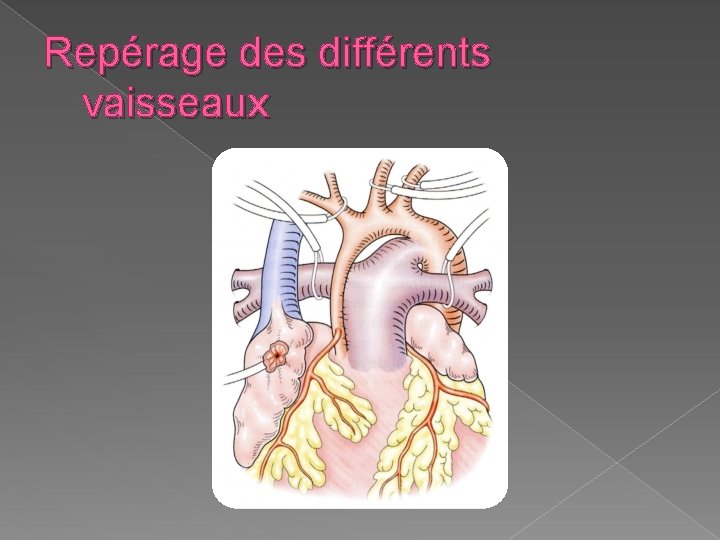 Repérage des différents vaisseaux 