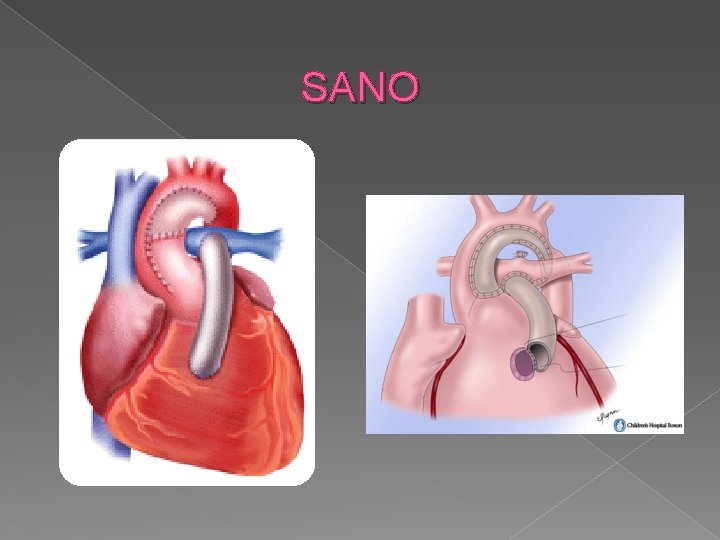 SANO 