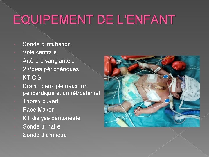 EQUIPEMENT DE L’ENFANT Sonde d’intubation Voie centrale Artère « sanglante » 2 Voies périphériques
