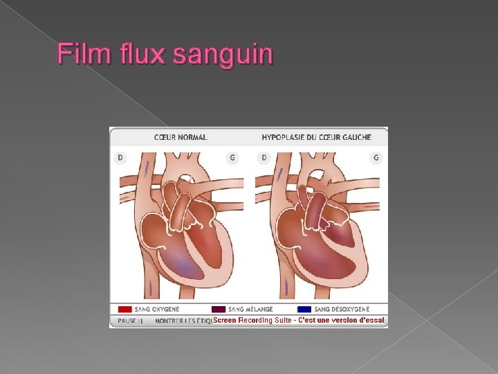 Film flux sanguin 