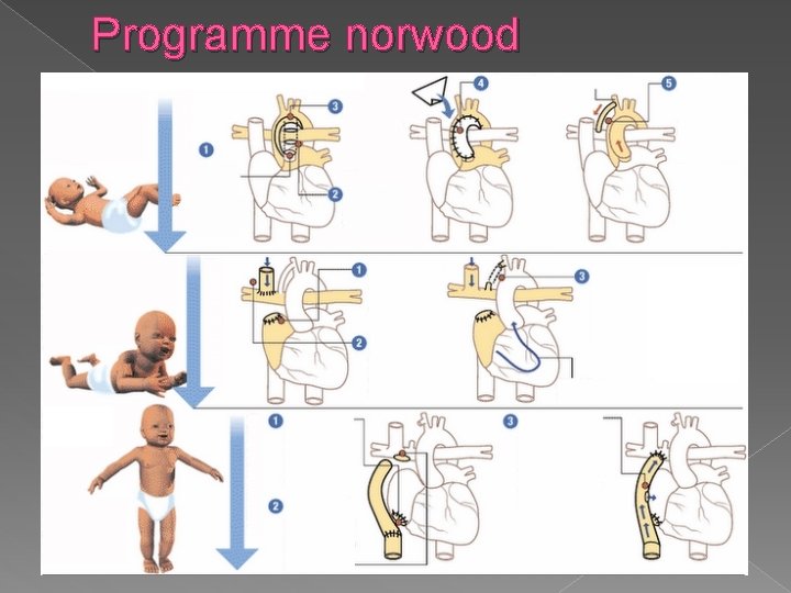 Entre 18 mois et 4 ans Entre 3 et 9 mois Après la naissance