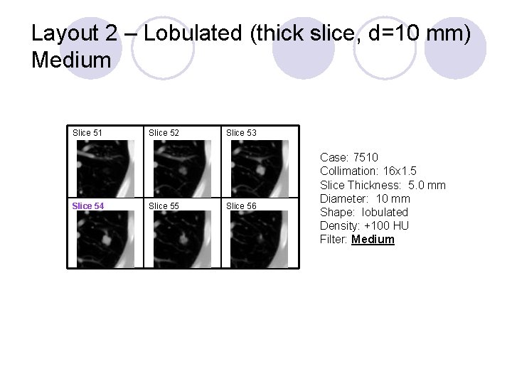 Layout 2 – Lobulated (thick slice, d=10 mm) Medium Slice 51 Slice 54 Slice