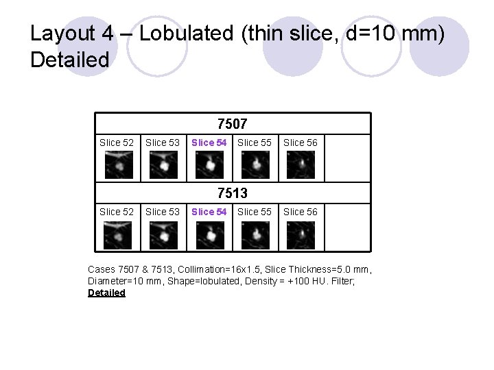 Layout 4 – Lobulated (thin slice, d=10 mm) Detailed 7507 Slice 52 Slice 53