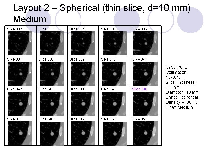 Layout 2 – Spherical (thin slice, d=10 mm) Medium Slice 332 Slice 333 Slice