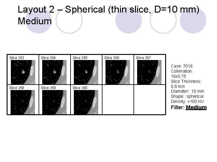 Layout 2 – Spherical (thin slice, D=10 mm) Medium Slice 353 Slice 358 Slice