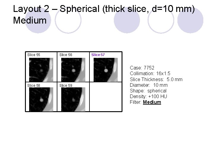 Layout 2 – Spherical (thick slice, d=10 mm) Medium Slice 55 Slice 58 Slice