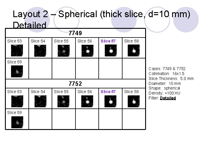 Layout 2 – Spherical (thick slice, d=10 mm) Detailed 7749 Slice 53 Slice 54