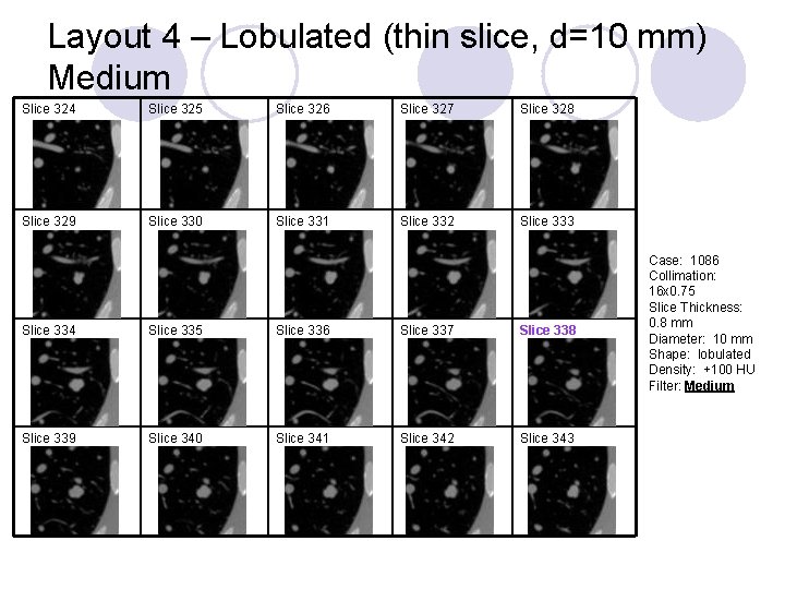 Layout 4 – Lobulated (thin slice, d=10 mm) Medium Slice 324 Slice 325 Slice