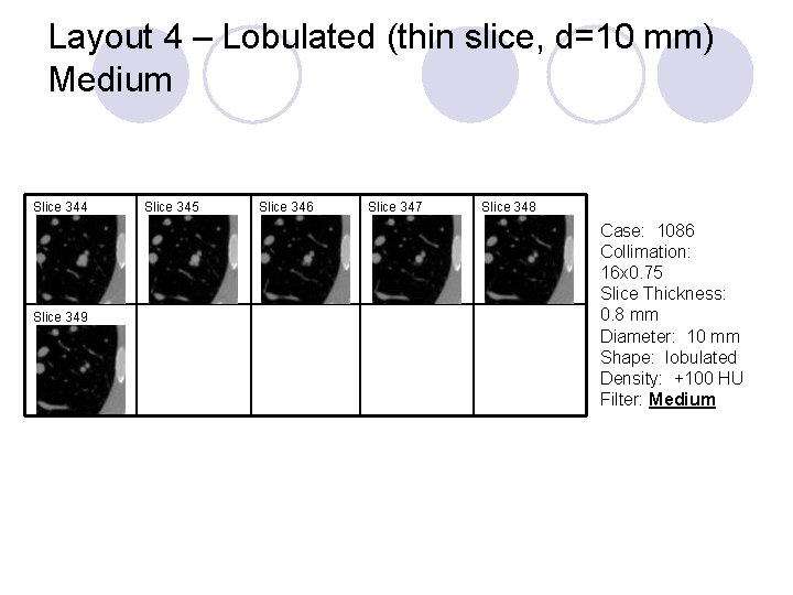 Layout 4 – Lobulated (thin slice, d=10 mm) Medium Slice 344 Slice 349 Slice