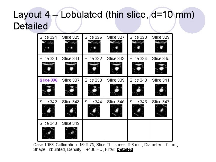 Layout 4 – Lobulated (thin slice, d=10 mm) Detailed Slice 324 Slice 325 Slice