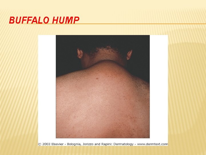 BUFFALO HUMP 