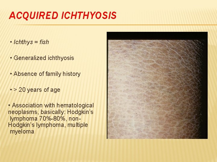 ACQUIRED ICHTHYOSIS • Ichthys = fish • Generalized ichthyosis • Absence of family history