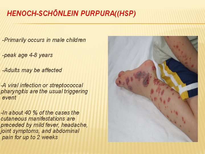 HENOCH-SCHÖNLEIN PURPURA((HSP) -Primarily occurs in male children -peak age 4 -8 years -Adults may