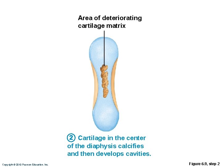 Area of deteriorating cartilage matrix 2 Cartilage in the center of the diaphysis calcifies Area of deteriorating cartilage matrix 2 Cartilage in the center of the diaphysis calcifies