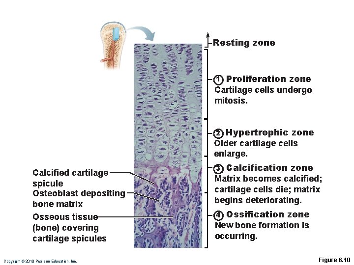 Resting zone Proliferation zone Cartilage cells undergo mitosis. 1 Hypertrophic zone Older cartilage cells Resting zone Proliferation zone Cartilage cells undergo mitosis. 1 Hypertrophic zone Older cartilage cells