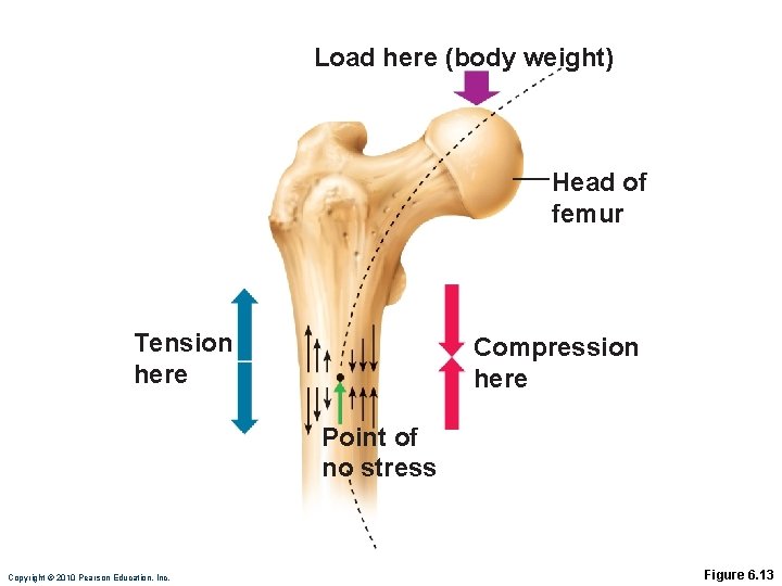 Load here (body weight) Head of femur Tension here Compression here Point of no Load here (body weight) Head of femur Tension here Compression here Point of no