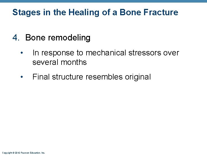 Stages in the Healing of a Bone Fracture 4. Bone remodeling • In response Stages in the Healing of a Bone Fracture 4. Bone remodeling • In response