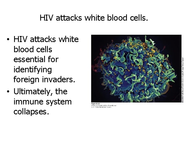 HIV attacks white blood cells. • HIV attacks white blood cells essential for identifying