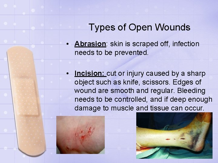 Types of Open Wounds • Abrasion: skin is scraped off, infection needs to be